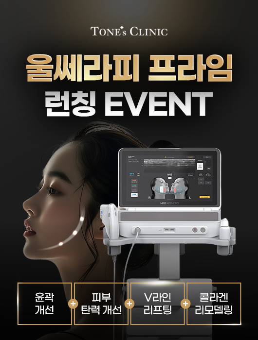 팝업
